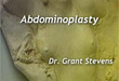 abdominoplasty los angeles